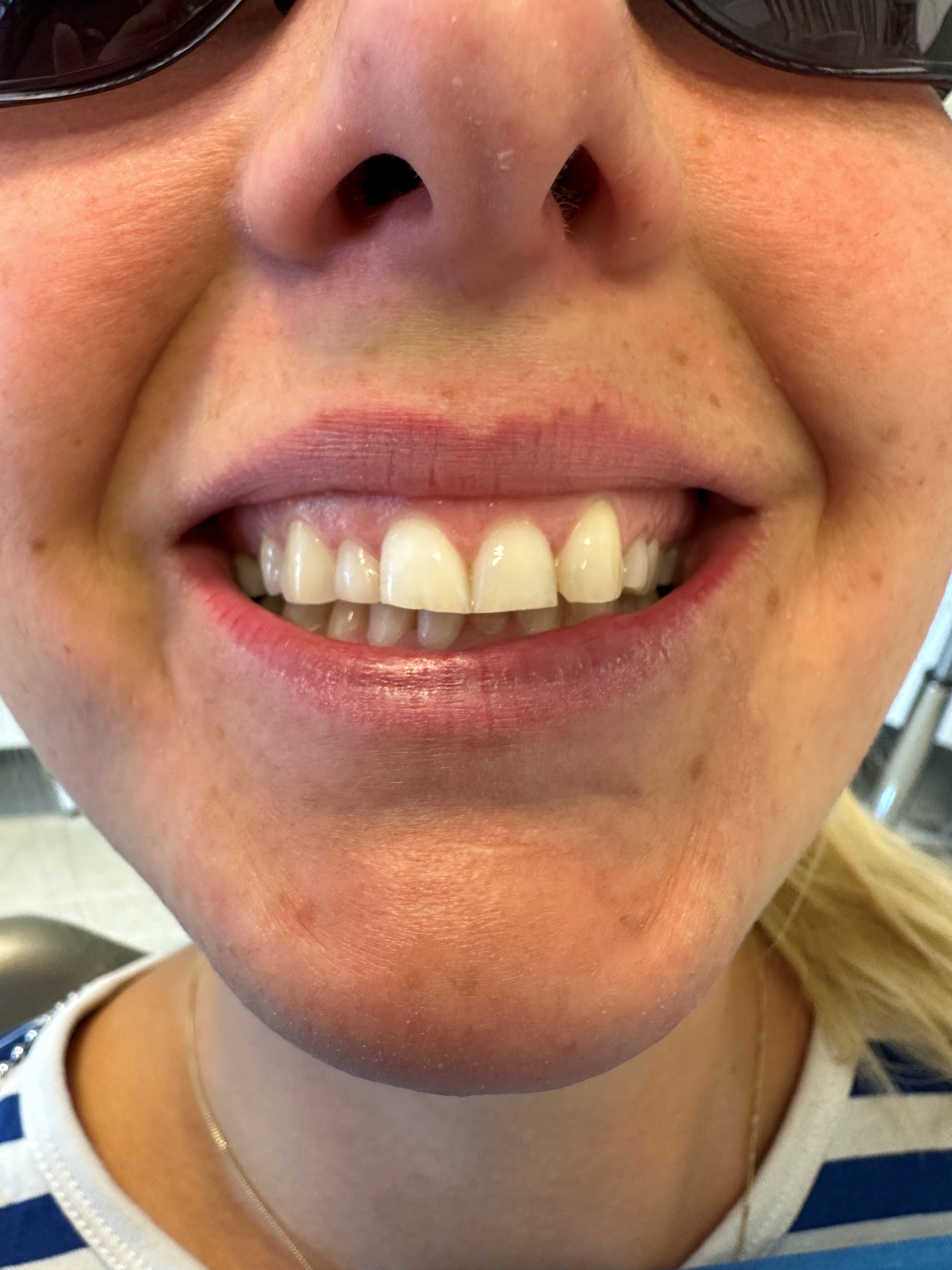 Yksi laminaatti d12 ja muovimuotoiluja