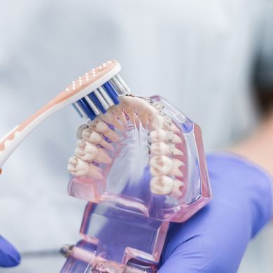 Hammaskivut & Hampaan Paikkaus