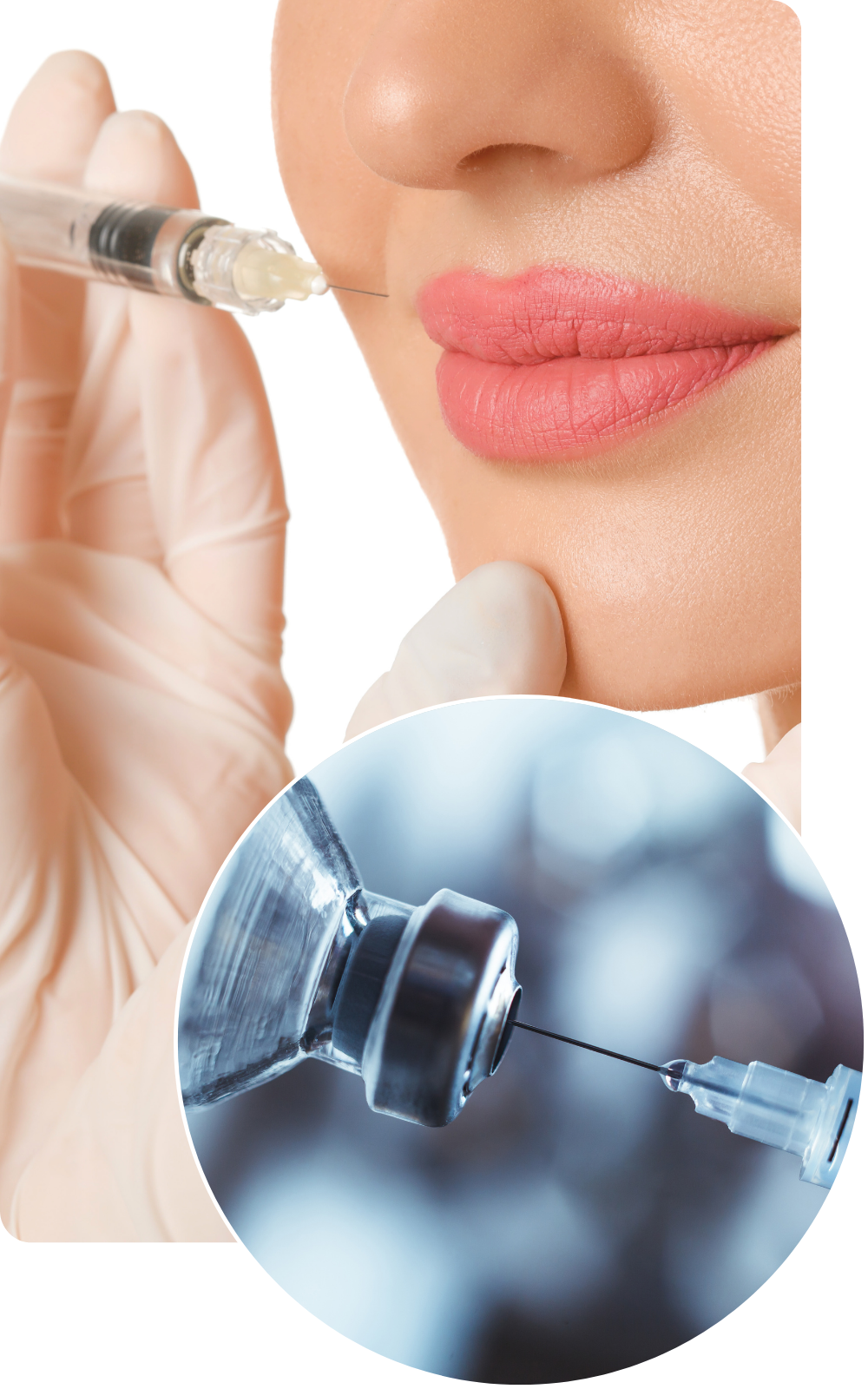 Toimenpiteen vaiheet