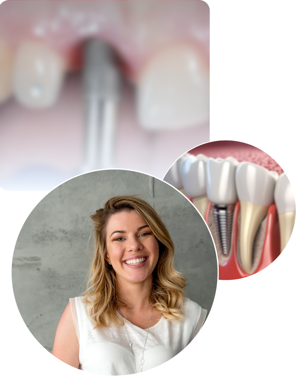 Toimenpiteen vaiheet