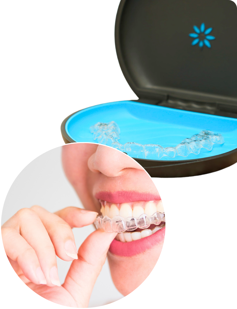 Toimenpiteen vaiheet