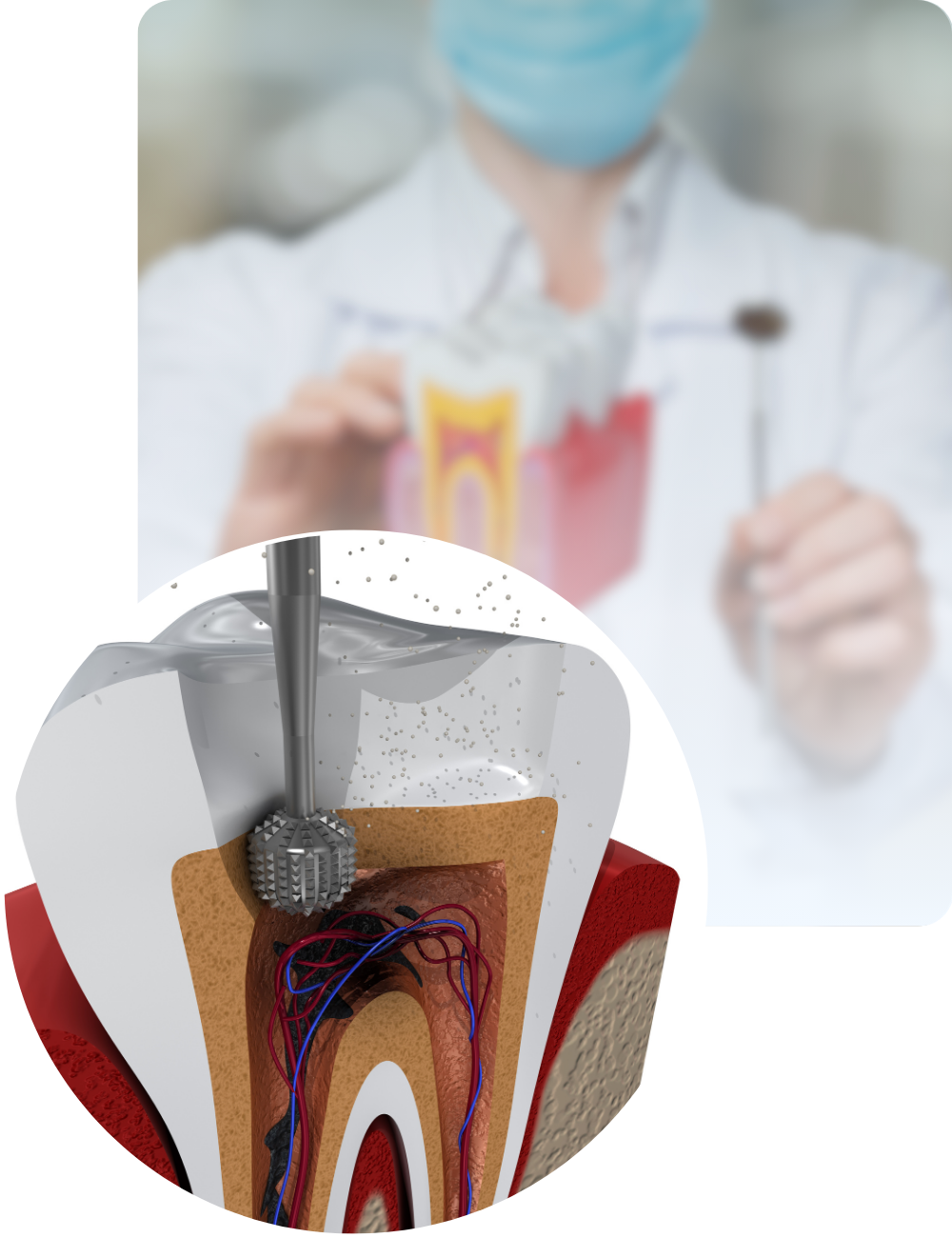 Toimenpiteen vaiheet