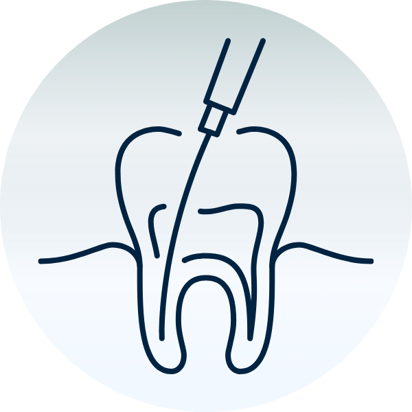 Juurihoidon etenee 2