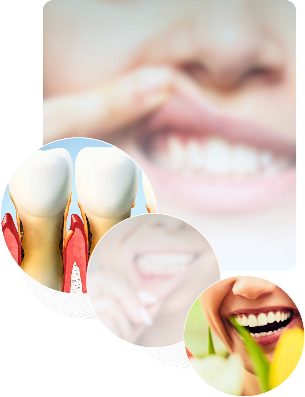 Toimenpiteen vaiheet