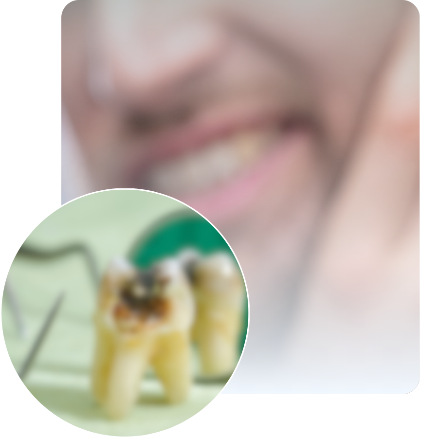 Toimenpiteen vaiheet